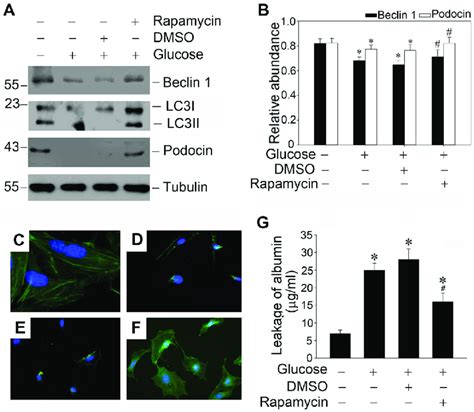 Rapamycin Restores Defective Autophagy Induced By High Glucose And Download Scientific Diagram