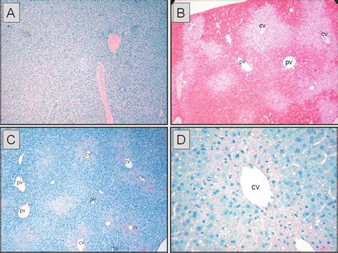 Immunohistochemical Staining Of Liver Sections For 4 Hydroxynonenal Download Scientific Diagram