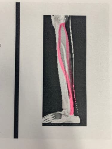 Lateral Compartment Of The Leg Flashcards Quizlet