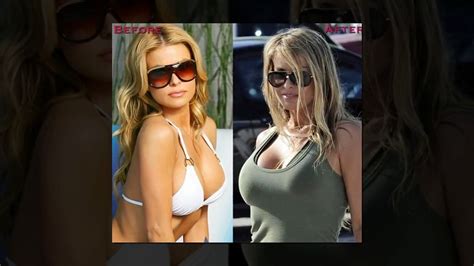 Top 10 Celebrities With The Most Expensive Breast Implants Dailymotion Video