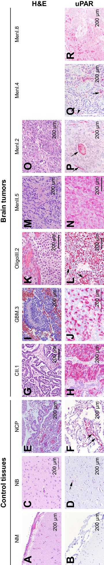 Immunohistochemical Evaluation Of UPar Expression In Control Canine