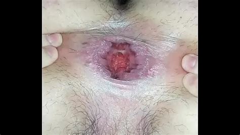 Perfect Pink Doodoo Hole 1 Nude Pics XHamster