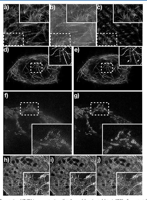 Super Resolution Structured Illumination Microscopy Semantic Scholar