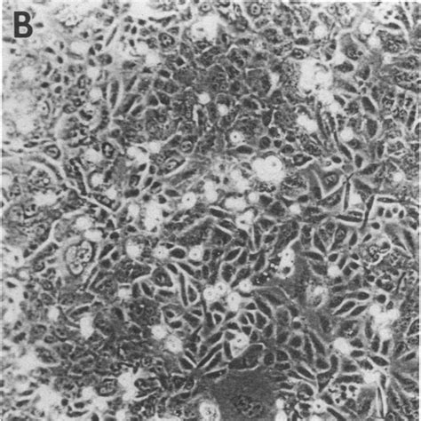 Morphology of cell lines. Phase contrast micrographs of SW480.7 (A), a ...