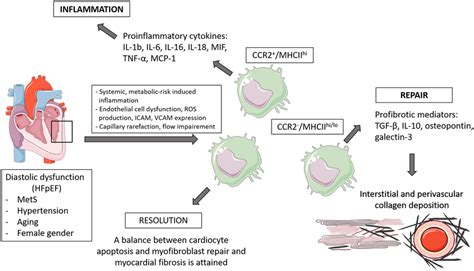 Schematic Presentation Of Major Macrophage Mediated Cardiac Remodeling