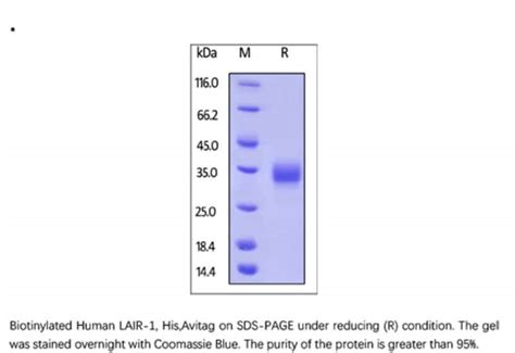 ACROBiosystems Recombinant Protein Biotinylated Human LAIR1 CD305