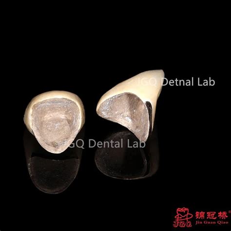 Dental Porcelain Fused To Metal Bridge With Full Metal Occlusal