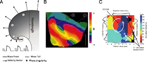 Spiral Wave Re Entry As Drivers Of Cardiac Fibrillation A Schematic