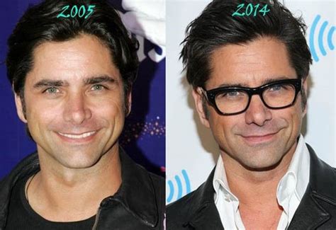 John Stamos before and after plastic surgery 08 – Celebrity plastic ...