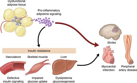 Obesity Induced Changes In Adipose Tissue Microenvironment And Their