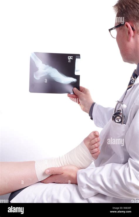 Doctor exam one X-ray picture of sprained foot Stock Photo - Alamy