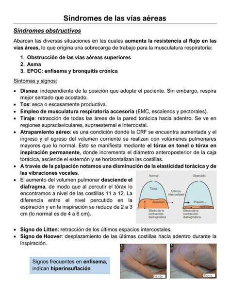 S Ndromes De Las V As A Reas Condensaci N Y Pleurales Jaz Udocz