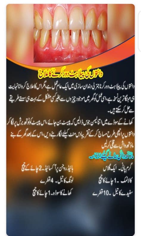 Teeth Care Tips دانتوں کی پیلاہٹ کا علاج