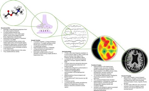 Deep Brain Stimulation For Alzheimer’s Disease Tackling Circuit Dysfunction Neuromodulation