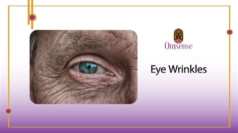 Eye Wrinkles: The Tell-Tale Sign of Aging