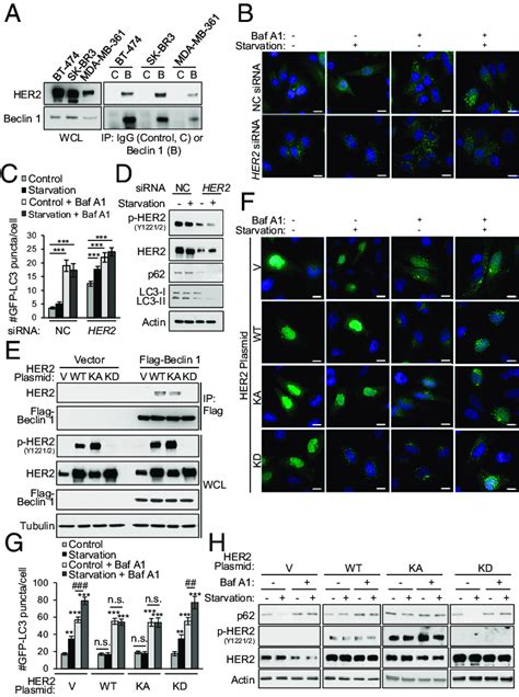 Her2 Interacts With Beclin 1 And Reduces Starvation Induced Autophagy