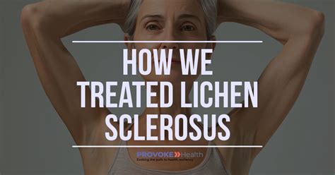 Personalized Treatment For Lichen Sclerosus A Case Study Part Two