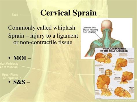 Ppt Cervical Spine Injuries Powerpoint Presentation Free Download