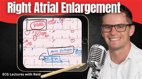 Right Atrial Enlargement Rae Ekg Ecg Lecture Youtube