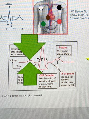 Cardiovascular Flashcards Quizlet