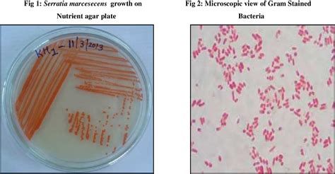 E Coli Gram Stain 100x