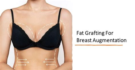 Fat Grafting For Breast Augmentation Dream Plastic Surgery