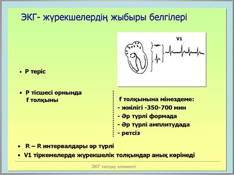 ЭКГ диагностикасы - презентация онлайн