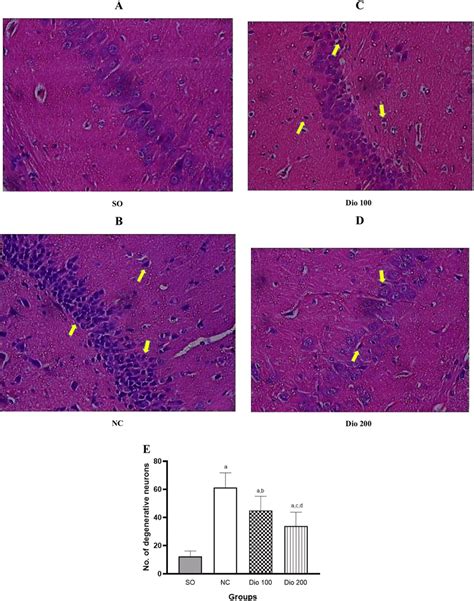 Histopathological Examination Of CA1 Region Of Hippocampus Stained With