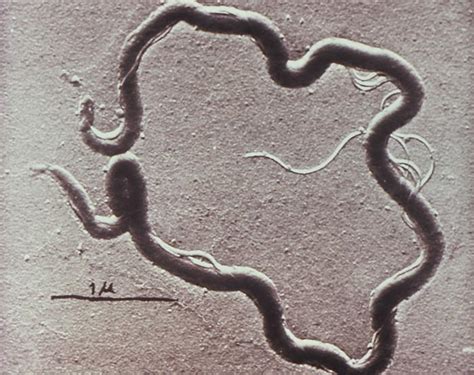 Syphilis Bacteria Shape