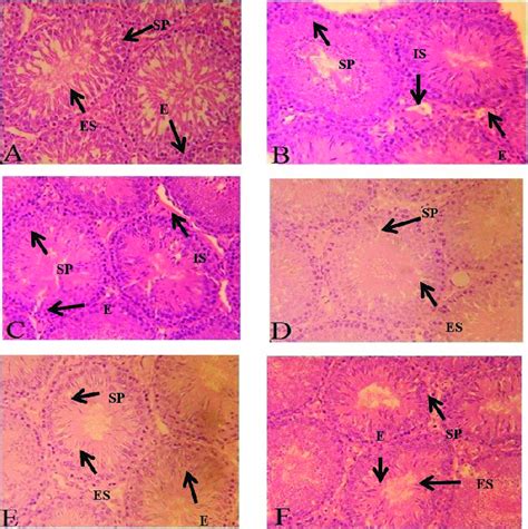 Photomicrograph of seminiferous tubules. (A) Control; showing compact ...