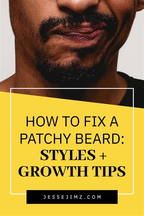 Not every man can grow a full beard - sometimes it’s plain patchy ...