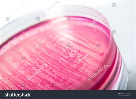 E Coli Petri Dish Bacterium Stock Photo 273826028 | Shutterstock