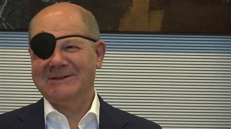 Watch: German Chancellor Olaf Scholz sports eye patch after accident ...