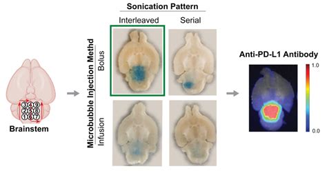 Successfully Opening A Larger Volume Of The Blood Brain Barrier