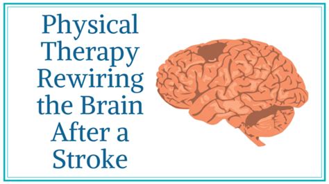 Physical Therapy Rewiring The Brain After A Stroke Oahu Spine Rehab