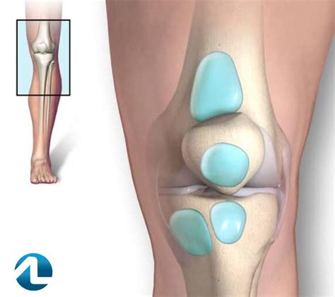 Bursite No Joelho Sintomas Diagnostico E Tratamento