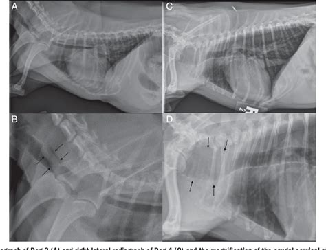 Figure 4 From Radiographic And Computed Tomographic Appearance Of