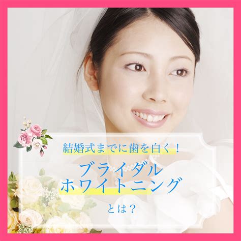 結婚式までに歯を白くするブライダルホワイトニングとは？ 南青山矯正歯科・審美歯科