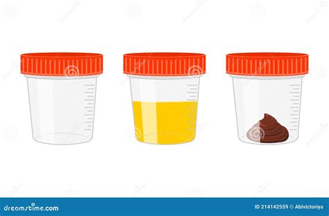 Urinalysis Urine Sample In Plastic Container Laboratory Examination