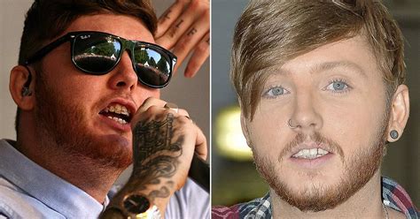 Celebrity teeth before and after: James Arthur debuts a brand new image ...