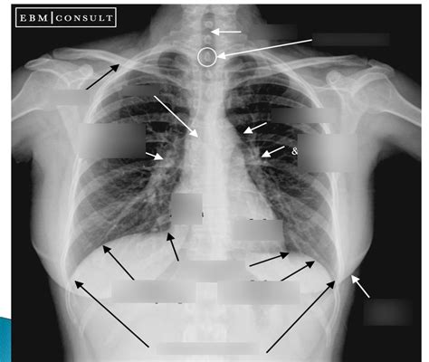 Radiographic anatomy diagram Diagram | Quizlet