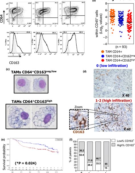 High Frequency Of CD163 TAMs Is Correlated With Higher Risk Of