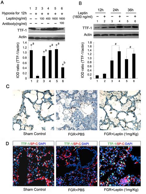 Effect Of Leptin On The Expression Of Ttf In Fetal Lungs And Type Ii