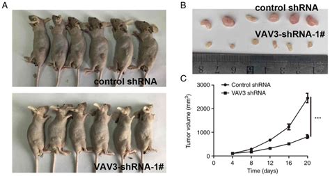 Vav3 Regulates Glioblastoma Cell Proliferation Migration Invasion And