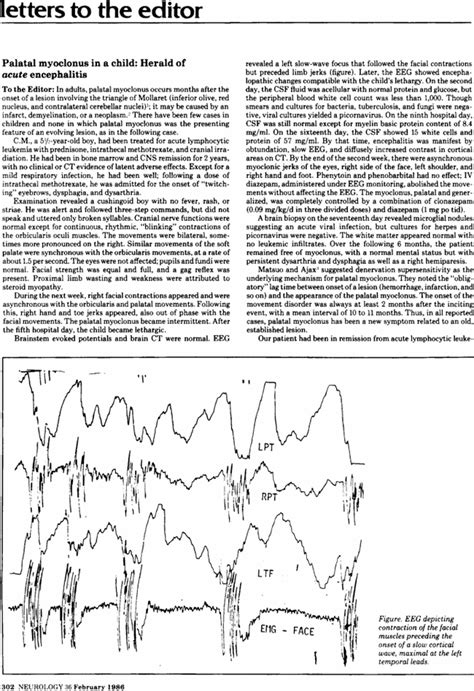 Palatal Myoclonus In A Child Neurology