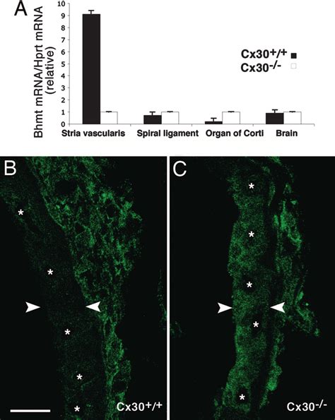 Down Regulation Of Bhmt And Increase In Hcy Concentration In The Sv Of