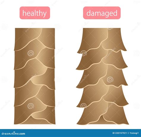 Damaged Cuticle Layer Cause Damaged Hair Cartoon Vector | CartoonDealer ...