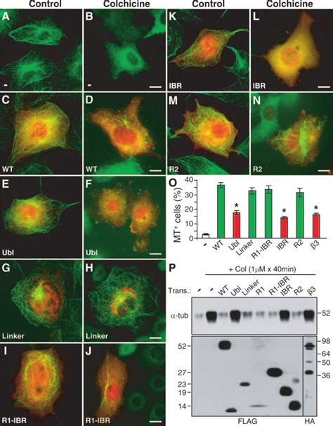 Expression Of Microtubule Binding Domains Of Parkin Attenuated