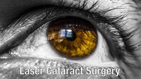 Cataract Surgery Plano Cataract Surgery Frisco Texas Eye