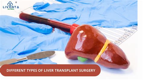 DIFFERENT TYPES OF LIVER TRANSPLANT SURGERY - Livonta Global Pvt Ltd